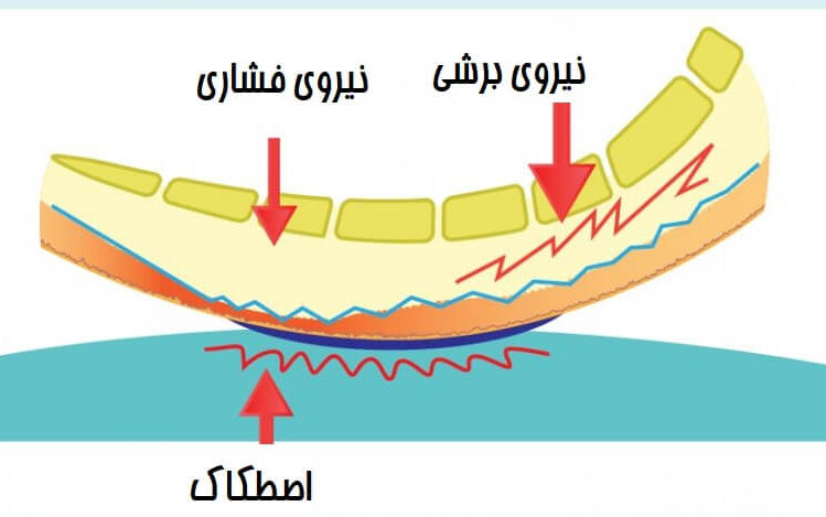 زخم فشاری