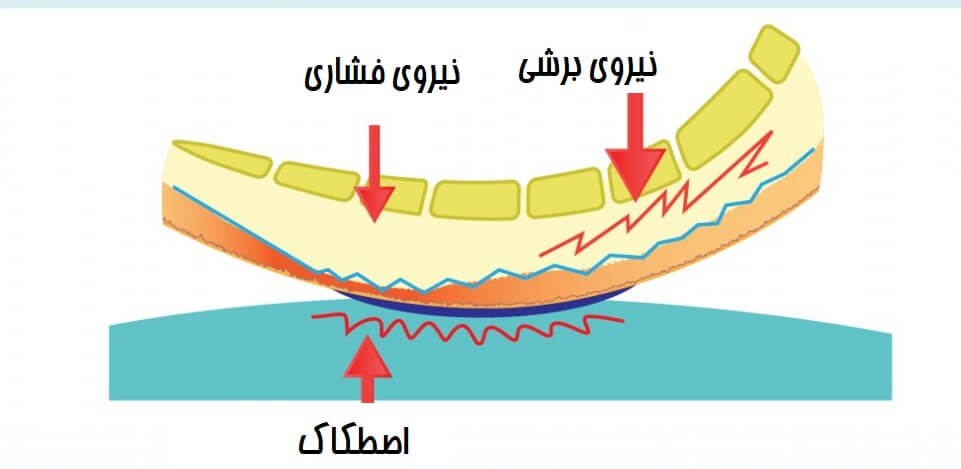 زخم فشاری