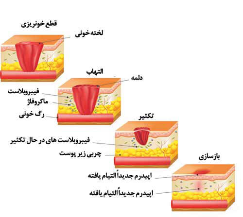 مراحل ترمیم زخم