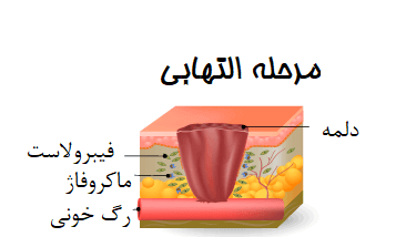 مرحله التهابی